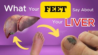 9 Warning Signs Your Feet Reveal About Your Liver Health [upl. by Afra]