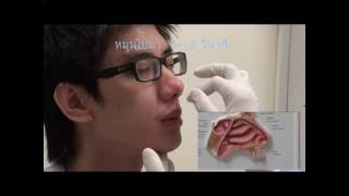 Nasopharyngeal swab by Assistant Professor Jumroon Tungkeeratichai [upl. by Litt]