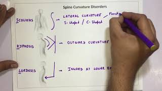 Spine Curvature Disorders  Scoliosis Kyphosis Lordosis [upl. by Barnabe]