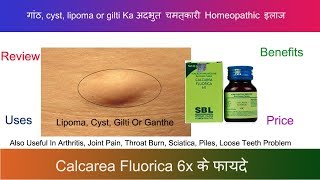 Calcarea Fluorica 6x गांठ का रामबांड इलाज Review amp Explain in 2022 [upl. by Ailgna]