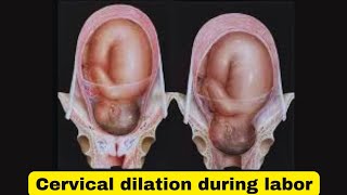 Cervical dilation how to check for laborhow to check if your cervix is dilated [upl. by Ignace]