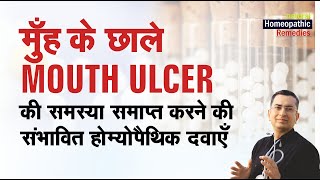 मुँह में छाले  Mouth Ulcers  Canker Sores  Natural Homeopathic remedies  होम्योपैथिक उपचार [upl. by Oribella]