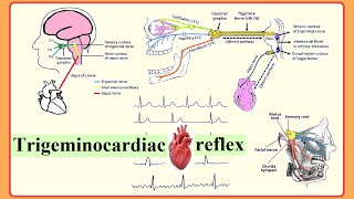 trigeminocardiac reflex [upl. by Christiane407]