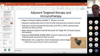 2022 ABSITE Review Surgical Oncology [upl. by Leahcam]