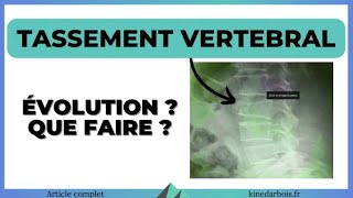 Tassement vertebral  conduite à tenir exercices opération [upl. by Erhard]