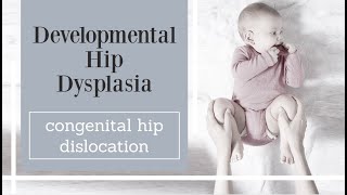 Developmental Hip Dysplasia  congenital hip dislocation [upl. by Silda]