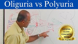 Oliguria vs Polyuria  Urine Output  Causes and Symptoms [upl. by Ahsemed370]