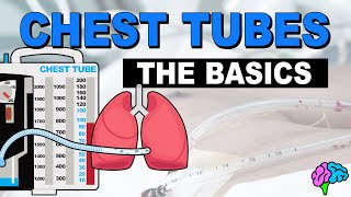 The Basics of Chest Tube Management [upl. by Akemit558]