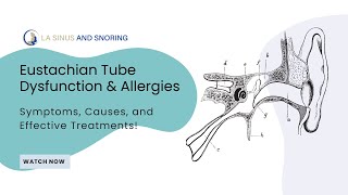 Eustachian Tube Dysfunction amp Allergies Symptoms Causes and Effective Treatments [upl. by Radferd]