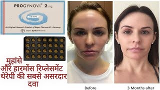 PROGYNOVAEstradiol2mg Tabletमुंहासे और हारमोंस रिप्लेसमेंट थेरेपी की सबसे असरदार दवा Full Review [upl. by Eema257]