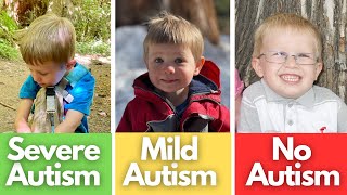 Signs of Mild Autism Severe Autism No Autism  Compared [upl. by Araik]