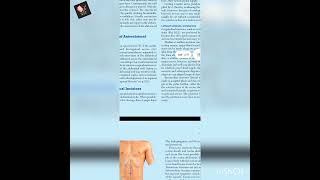 01 Fascia and fascial spaces of anterolateral abdomen wall  Neurovasculature of abdominal wall [upl. by Ahsiekram]