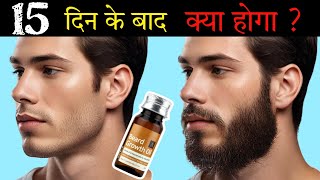 Ustraa Beard Growth Oil After 15 Days Review  Best Beard Oil For Patchy Beard in India 2024 [upl. by Wilson961]