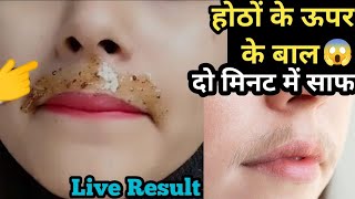 इस चीज से होठों के ऊपर के बाल ऐसे हट गए😱 2 मिनट में मैं तो हैरान हू🤔 upper lip hair removal [upl. by Lertsek263]