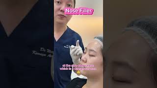 Where and How Fillers are Injected [upl. by Eanar502]