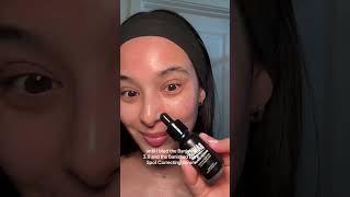 How to get rid of hyperpigmentation and acne scars [upl. by Scharff189]