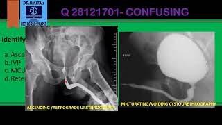 IDENTIFYING INVESTIGATIONS OF URINARY SYSTEM IVPRGPASUMCU [upl. by Idieh450]