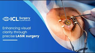 Enhancing visual clarity through precise LASIK surgery [upl. by Zanas]