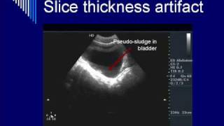 Physics of Ultrasound Image Artifacts Segment 2 [upl. by Akla]