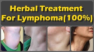 Top 7 Herbal Treatments for Lymphoma And Common Signs Of Lymphoma And Risk Of Lymphoma Cancer [upl. by Leighton]