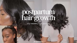 Postpartum Hair Loss  10 Things I Did To Get My Hair Healthy and Growing [upl. by Atinas178]