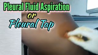 Pleural fluid aspiration [upl. by Ahsiret]