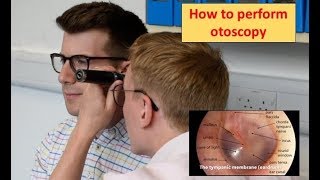 How to perform Otoscopy Ear Exam [upl. by Noimad]