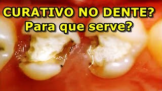 Curativo no dente  para que serve [upl. by Liakim663]