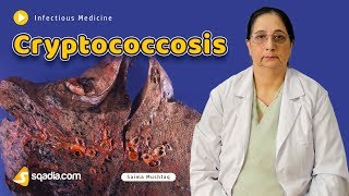 Cryptococcosis  Infectious Medicine Video Lectures  Medical Education  VLearning [upl. by Lebezej]