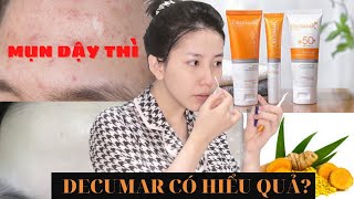 Trị mụn tận gốc tận nhà Combo trị mụn Decumar có thực sự hiệu quả  Mai Trinh Official [upl. by Miriam879]