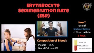 Erythrocyte Sedimentation Rate  ESR  Tamil  Medical Lab Technology  Biology  ThiNK VISION [upl. by Rodd873]