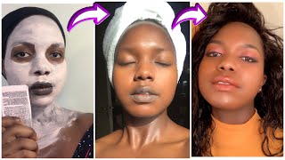 Jinsi ya Kuondoa CHUNUSI Usoni na MAKOVU kwa Haraka 2021 How to get rid of acne Fast [upl. by Ulrika14]