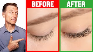 How to Grow Long Thick Eyelashes QUICKLY  Dr Berg [upl. by Farah905]