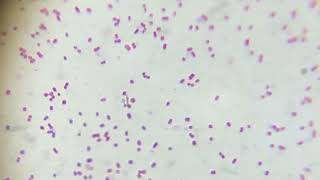 Morphologie du Streptococcus pneumoniae au microscope [upl. by Alimac860]