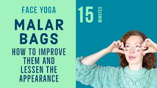 Face Yoga to Improve Malar Bags Eye Bags and Puffiness [upl. by Anastassia578]