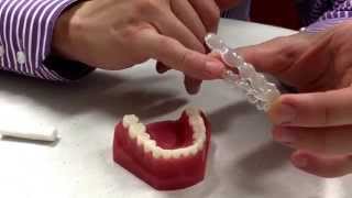 Sharp edges with your Invisalign plates how and what to do Dr Andrew Chang Smiles amp Faces Ortho [upl. by Perseus]