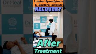 Lumbar Spondylosis amp Bilateral Sciatica Recovery After Treatment yt ad viralvideo reachout [upl. by Raynah]