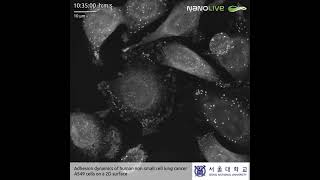 Adhesion dynamics of human non‐small cell lung cancer A549 cells on a 2D surface [upl. by Nahta815]