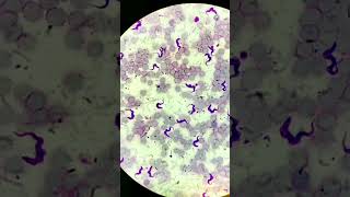 Trypanosoma under microscope microscopic parasitology Trypanosomiasis [upl. by Wenoa]