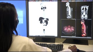 PSMA PET Scan Used For Prostate Cancer – Memorial Cancer Institute [upl. by Alessandra645]