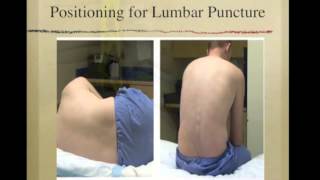 Lumbar Puncture [upl. by Herbert]