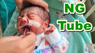 Nasogastric NG Tube Insertion in NeonateNewborn  Orogastric OG TubeFeeding Tube  Paediatric [upl. by Oster426]