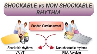 SHOCKABLE vs NON SHOCKABLE RHYTHM [upl. by Alaj]