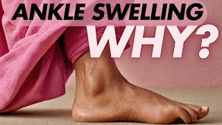 Say Goodbye to Swelling in Foot  ਗਿੱਟੇ ਪੈਰ ਦੀ ਸੋਜ [upl. by Brelje]