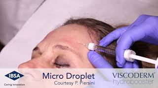 Viscoderm Hydrobooster  Microdroplet Technique Forehead Area [upl. by Guerin]