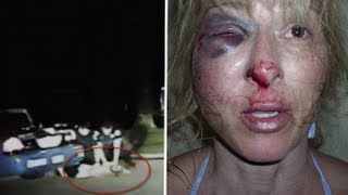 Police brutality Tallahassee cops break Christina Wests cheek in DUI stop [upl. by Milurd]