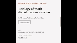 Etiology of tooth discoloration a review  RTCLTV [upl. by Anoo800]