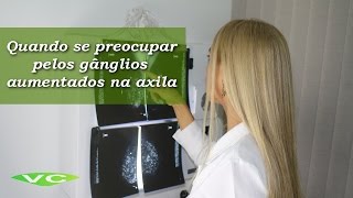 Gânglios na Axila ⚠️ ALERTA ⚠️ Quando deve se PREOCUPAR  Dra Vanderlea Coelho ®️ Câncer de Mama [upl. by Let509]