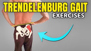 3 Exercises to Correct a Trendelenburg Gait Pattern [upl. by Aime]