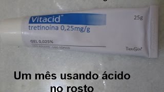 Como estou usando ácido tretinoína  Vitacid 1 [upl. by Llenyr792]